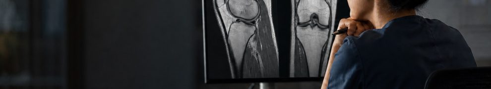 Clinician reviews de-identified knee MRI images on a bright monitor in a dim reading room